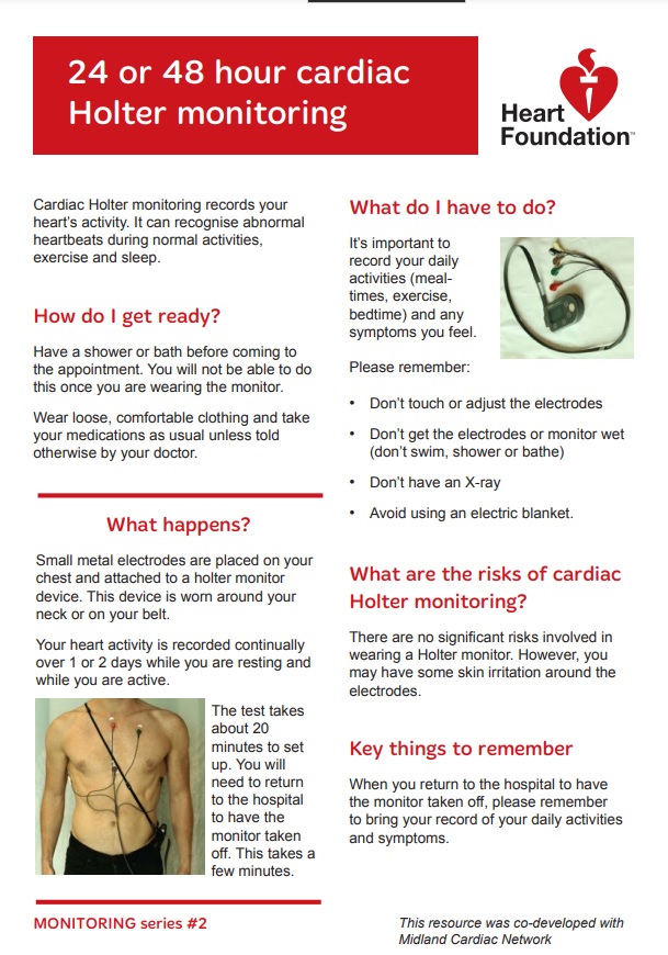 24 or 48 hour cardiac holter monitoring