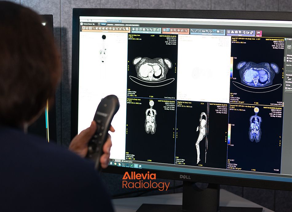 Allevia Radiology locations