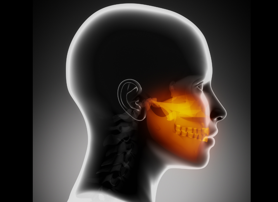 Graphic illustration of jaw 