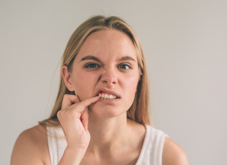 Woman showing sore, red gums