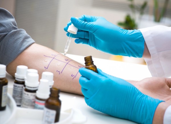 Skin test for allergy being done