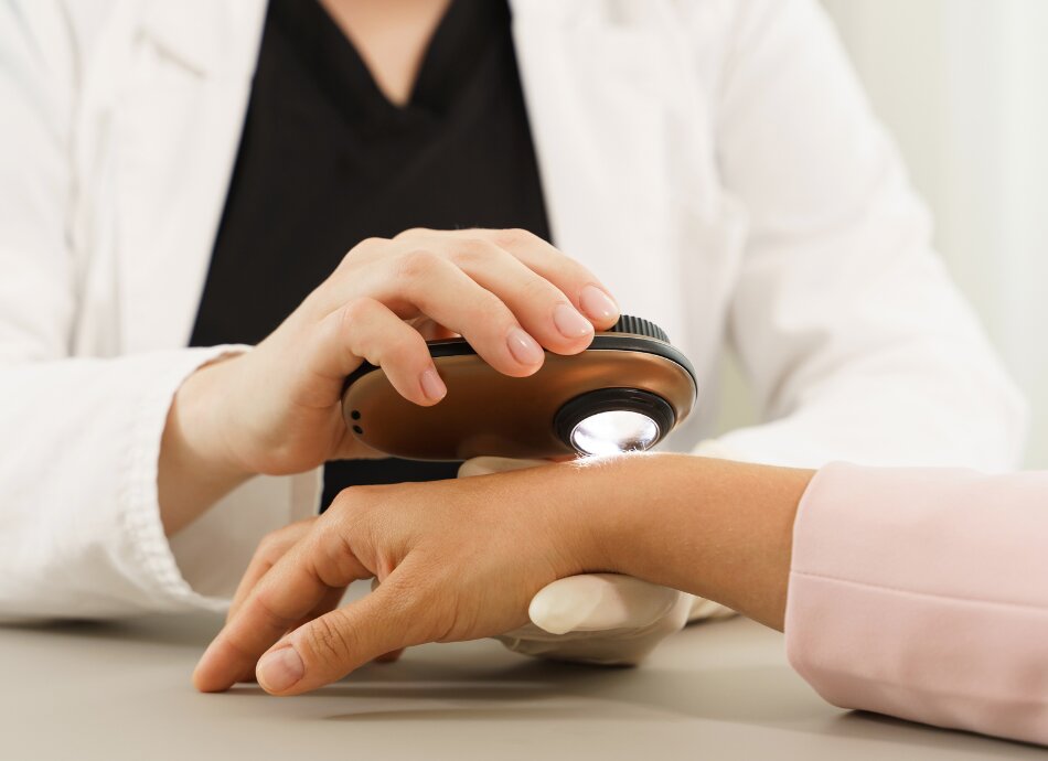 Person getting skin check on hand 