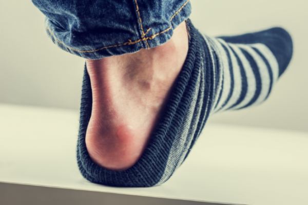 Foot with sock pulled down showing blister on heel