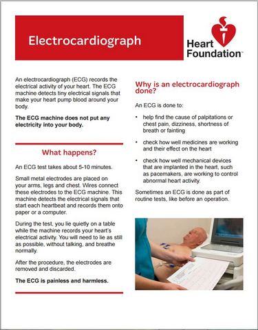 ecg