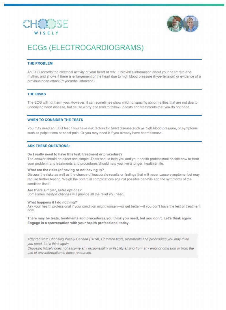 ecgs