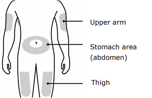 Image of injection sites